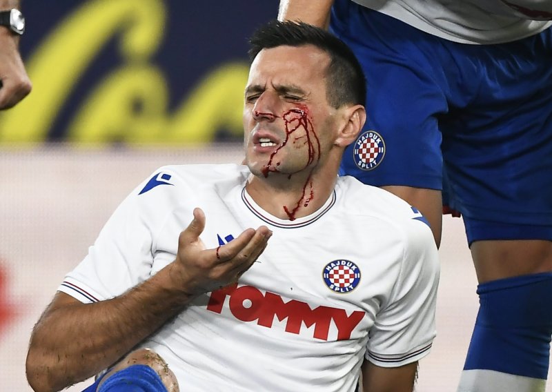 Nikola Kalinić krvlju platio gol koji ostavlja nadu Hajduku